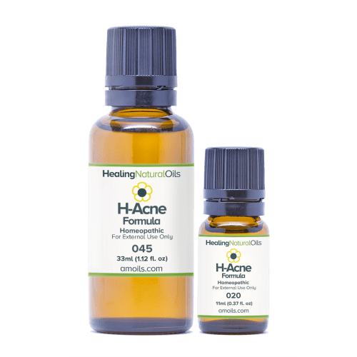 H-Acne Formula